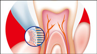 Dental internal vector